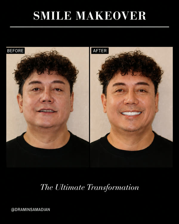 Smile Makeover Before & After Gallery - Patient 10 - Image 1